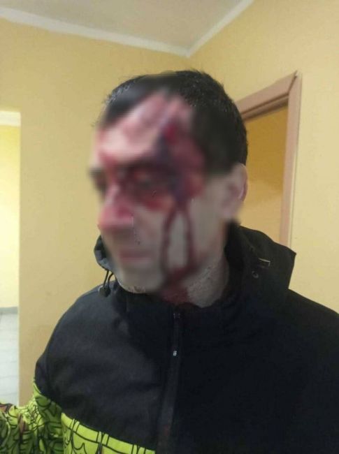 В Подмосковье приезжий разбил палкой голову местному жителю  Вчера в одном из пригородов произошел..