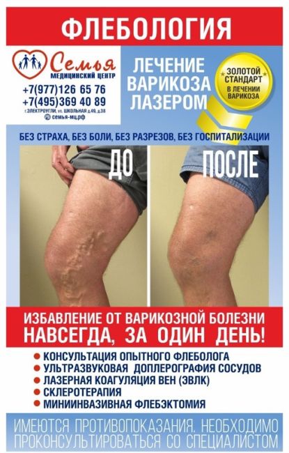 🔺ДИАГНОСТИКА и ЛЕЧЕНИЕ варикозной болезни вен по цене от 3700 руб.  ☝В нашем медицинском центре мы проводим..