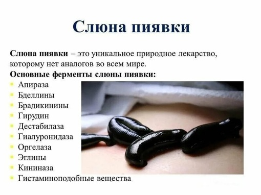 Мастер-класс "Постановка пиявок" от гирудотерапевта и остеопата [club164387773|Массаж.Вакуумные..