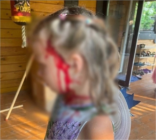 Мигрант разбил камнем голову маленькой девочке. 
В Московской области девочка продавала самодельные..