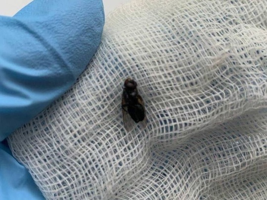 😳Медики Видновской больницы вытащили из носа 51-летнего мужчины живую муху. Насекомое попало в ноздрю, когда..