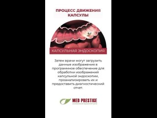 💊Капсульная эндоскопия, только в клинике Мед Престиж🏥, без боли и наркоза!  🌿Капсульная эндоскопия — это..